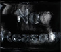 No Reason